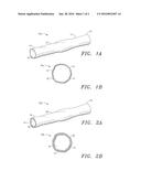 Prosthetic Vascular Conduits for Cardiovascular Structures diagram and image