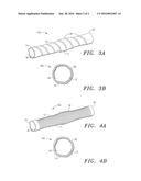 Prosthetic Vascular Conduits for Cardiovascular Structures diagram and image