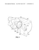 ENDOLUMINAL PROSTHESIS HAVING MULTIPLE BRANCHES OR FENESTRATIONS AND     METHODS OF DEPLOYMENT diagram and image