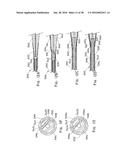 ENDOLUMINAL PROSTHESIS HAVING MULTIPLE BRANCHES OR FENESTRATIONS AND     METHODS OF DEPLOYMENT diagram and image