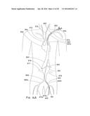 ENDOLUMINAL PROSTHESIS HAVING MULTIPLE BRANCHES OR FENESTRATIONS AND     METHODS OF DEPLOYMENT diagram and image