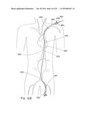 ENDOLUMINAL PROSTHESIS HAVING MULTIPLE BRANCHES OR FENESTRATIONS AND     METHODS OF DEPLOYMENT diagram and image