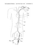 ENDOLUMINAL PROSTHESIS HAVING MULTIPLE BRANCHES OR FENESTRATIONS AND     METHODS OF DEPLOYMENT diagram and image