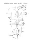 ENDOLUMINAL PROSTHESIS HAVING MULTIPLE BRANCHES OR FENESTRATIONS AND     METHODS OF DEPLOYMENT diagram and image