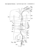 ENDOLUMINAL PROSTHESIS HAVING MULTIPLE BRANCHES OR FENESTRATIONS AND     METHODS OF DEPLOYMENT diagram and image