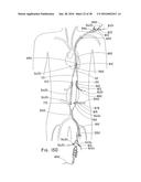 ENDOLUMINAL PROSTHESIS HAVING MULTIPLE BRANCHES OR FENESTRATIONS AND     METHODS OF DEPLOYMENT diagram and image