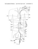 ENDOLUMINAL PROSTHESIS HAVING MULTIPLE BRANCHES OR FENESTRATIONS AND     METHODS OF DEPLOYMENT diagram and image