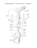 ENDOLUMINAL PROSTHESIS HAVING MULTIPLE BRANCHES OR FENESTRATIONS AND     METHODS OF DEPLOYMENT diagram and image