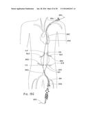 ENDOLUMINAL PROSTHESIS HAVING MULTIPLE BRANCHES OR FENESTRATIONS AND     METHODS OF DEPLOYMENT diagram and image