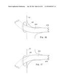 ENDOLUMINAL PROSTHESIS HAVING MULTIPLE BRANCHES OR FENESTRATIONS AND     METHODS OF DEPLOYMENT diagram and image