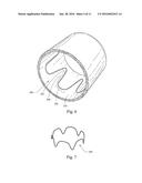 LOW PROFILE NON-SYMMETRICAL STENT diagram and image