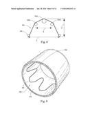 LOW PROFILE NON-SYMMETRICAL STENT diagram and image