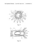 LOW PROFILE NON-SYMMETRICAL STENT diagram and image