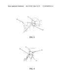 APPARATUS AND METHOD FOR LIGAMENT RECONSTRUCTION diagram and image