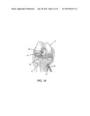 APPARATUS AND METHOD FOR LIGAMENT RECONSTRUCTION diagram and image