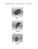 APPARATUS AND METHOD FOR LIGAMENT RECONSTRUCTION diagram and image