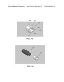 APPARATUS AND METHOD FOR LIGAMENT RECONSTRUCTION diagram and image