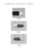 APPARATUS AND METHOD FOR LIGAMENT RECONSTRUCTION diagram and image