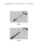 APPARATUS AND METHOD FOR LIGAMENT RECONSTRUCTION diagram and image