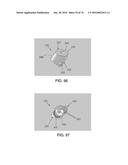 APPARATUS AND METHOD FOR LIGAMENT RECONSTRUCTION diagram and image