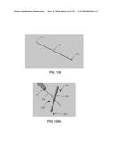 APPARATUS AND METHOD FOR LIGAMENT RECONSTRUCTION diagram and image