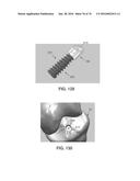 APPARATUS AND METHOD FOR LIGAMENT RECONSTRUCTION diagram and image