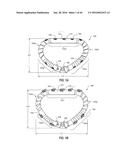 SYSTEMS AND METHODS FOR DELIVERY OF ANNULOPLASTY RINGS diagram and image