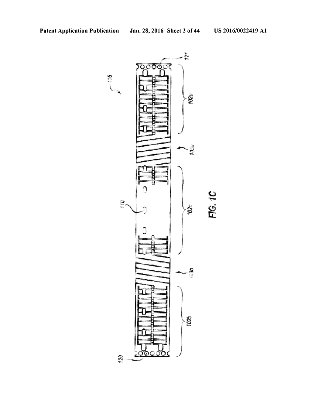 SYSTEMS AND METHODS FOR DELIVERY OF ANNULOPLASTY RINGS - diagram, schematic, and image 03