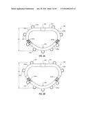 SYSTEMS AND METHODS FOR DELIVERY OF ANNULOPLASTY RINGS diagram and image