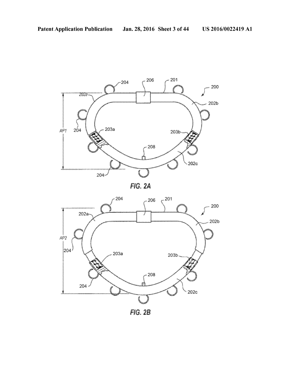 SYSTEMS AND METHODS FOR DELIVERY OF ANNULOPLASTY RINGS - diagram, schematic, and image 04