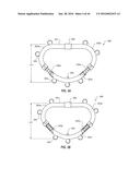 SYSTEMS AND METHODS FOR DELIVERY OF ANNULOPLASTY RINGS diagram and image