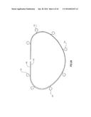 SYSTEMS AND METHODS FOR DELIVERY OF ANNULOPLASTY RINGS diagram and image