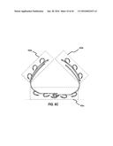 SYSTEMS AND METHODS FOR DELIVERY OF ANNULOPLASTY RINGS diagram and image