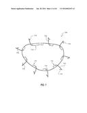 SYSTEMS AND METHODS FOR DELIVERY OF ANNULOPLASTY RINGS diagram and image