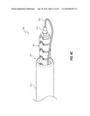 SYSTEMS AND METHODS FOR DELIVERY OF ANNULOPLASTY RINGS diagram and image