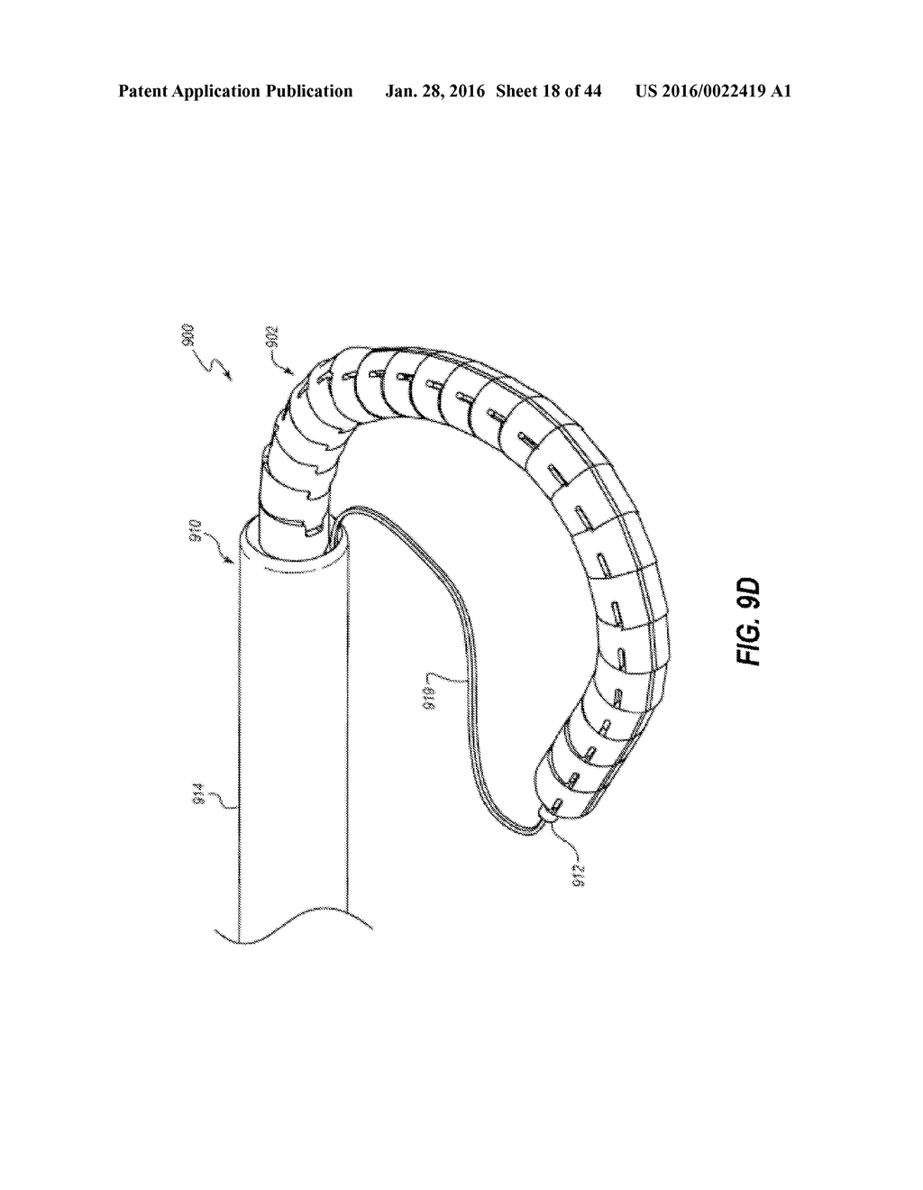 SYSTEMS AND METHODS FOR DELIVERY OF ANNULOPLASTY RINGS - diagram, schematic, and image 19