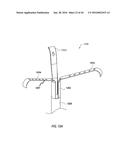 SYSTEMS AND METHODS FOR DELIVERY OF ANNULOPLASTY RINGS diagram and image