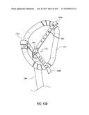 SYSTEMS AND METHODS FOR DELIVERY OF ANNULOPLASTY RINGS diagram and image