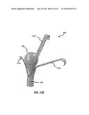 SYSTEMS AND METHODS FOR DELIVERY OF ANNULOPLASTY RINGS diagram and image