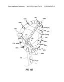 SYSTEMS AND METHODS FOR DELIVERY OF ANNULOPLASTY RINGS diagram and image