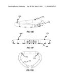 SYSTEMS AND METHODS FOR DELIVERY OF ANNULOPLASTY RINGS diagram and image