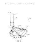 SYSTEMS AND METHODS FOR DELIVERY OF ANNULOPLASTY RINGS diagram and image