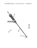 SYSTEMS AND METHODS FOR DELIVERY OF ANNULOPLASTY RINGS diagram and image