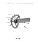 SYSTEMS AND METHODS FOR DELIVERY OF ANNULOPLASTY RINGS diagram and image