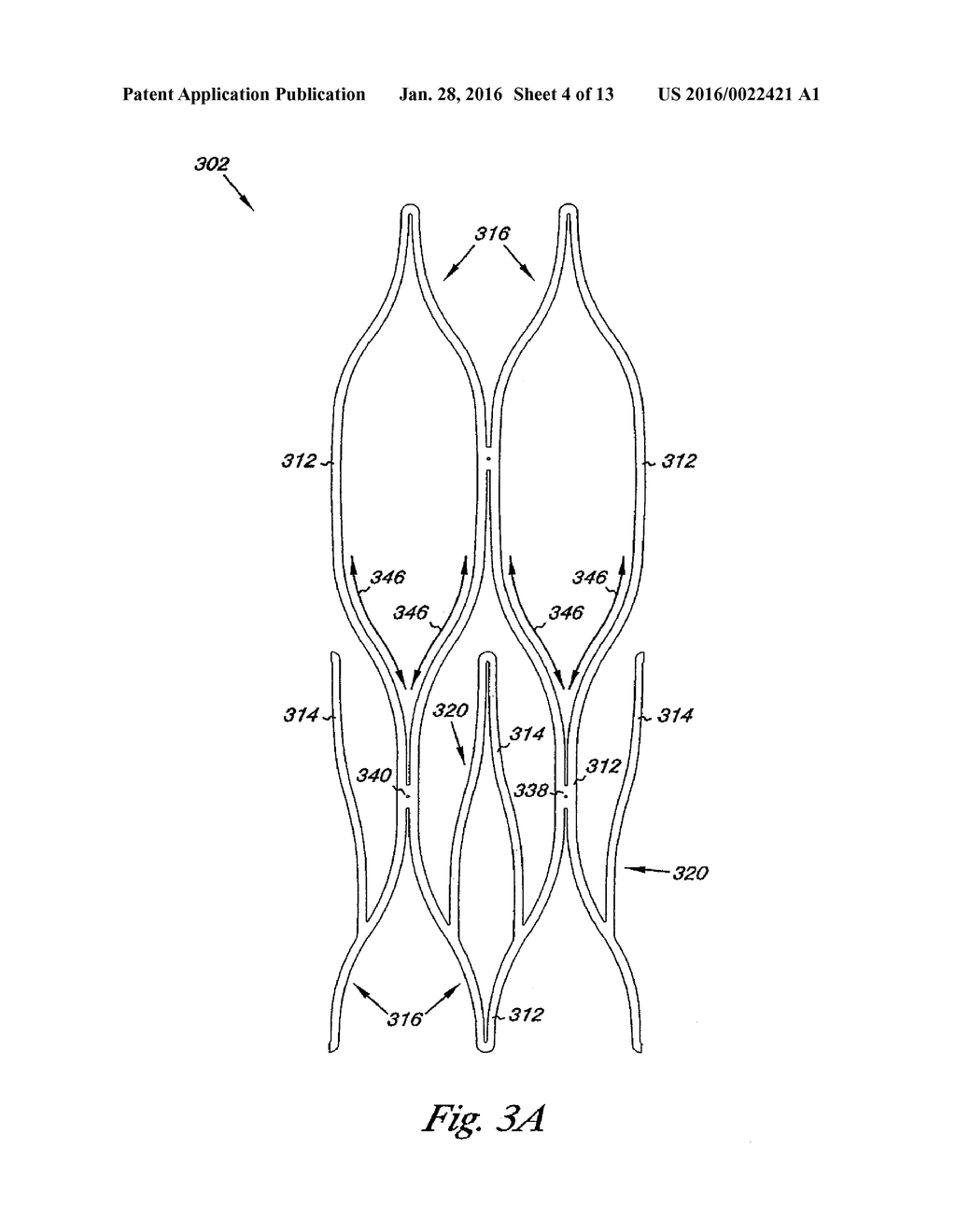 VENOUS VALVE, SYSTEM, AND METHOD WITH SINUS POCKET - diagram, schematic, and image 05