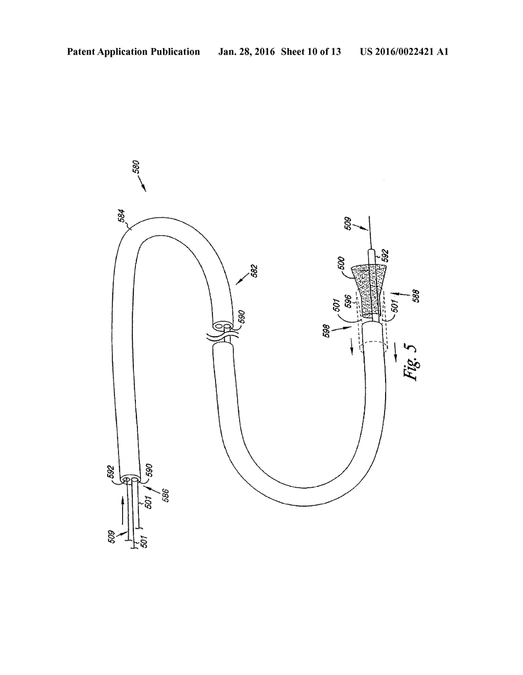 VENOUS VALVE, SYSTEM, AND METHOD WITH SINUS POCKET - diagram, schematic, and image 11