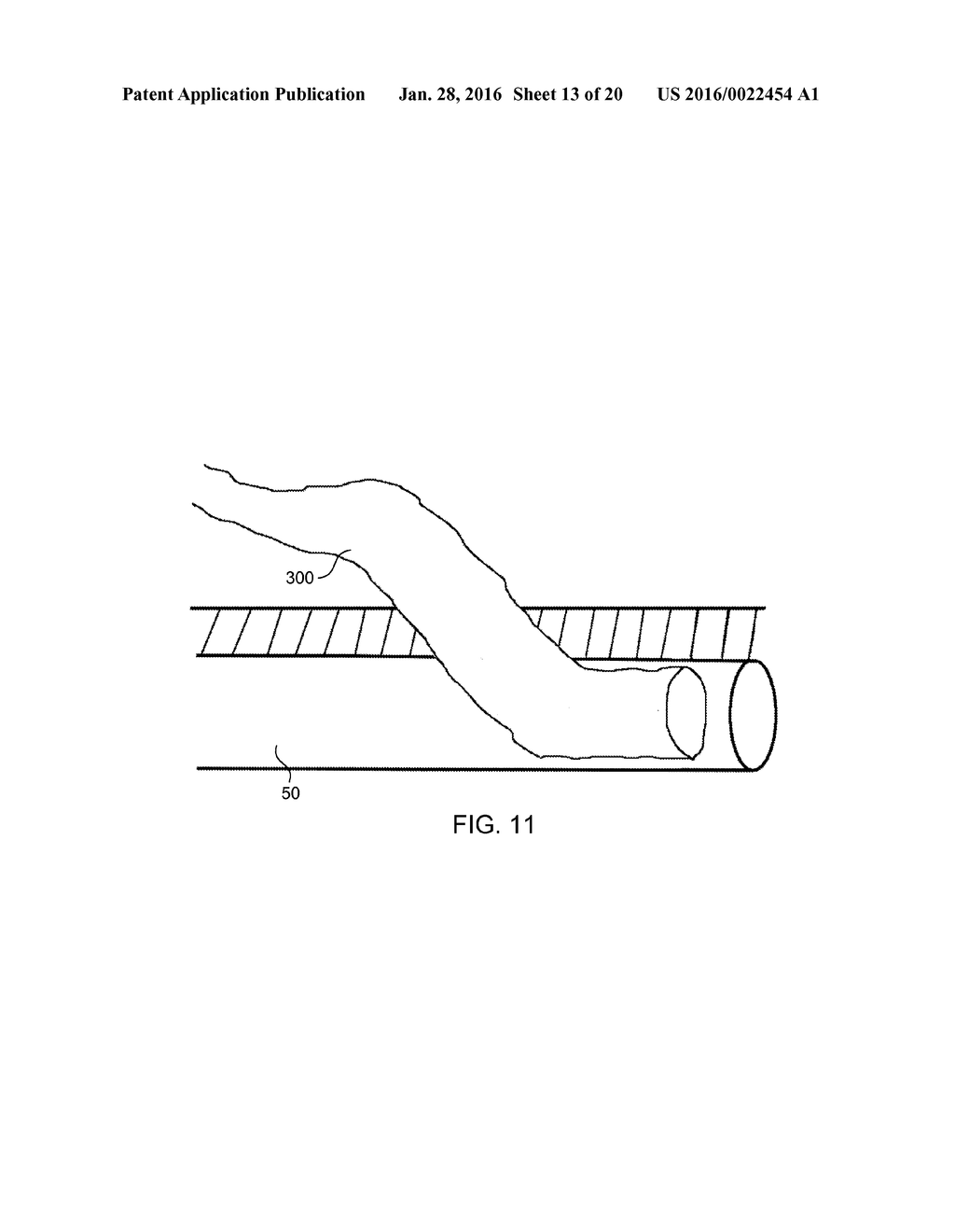 ANATOMIC NEEDLE SYSTEM - diagram, schematic, and image 14