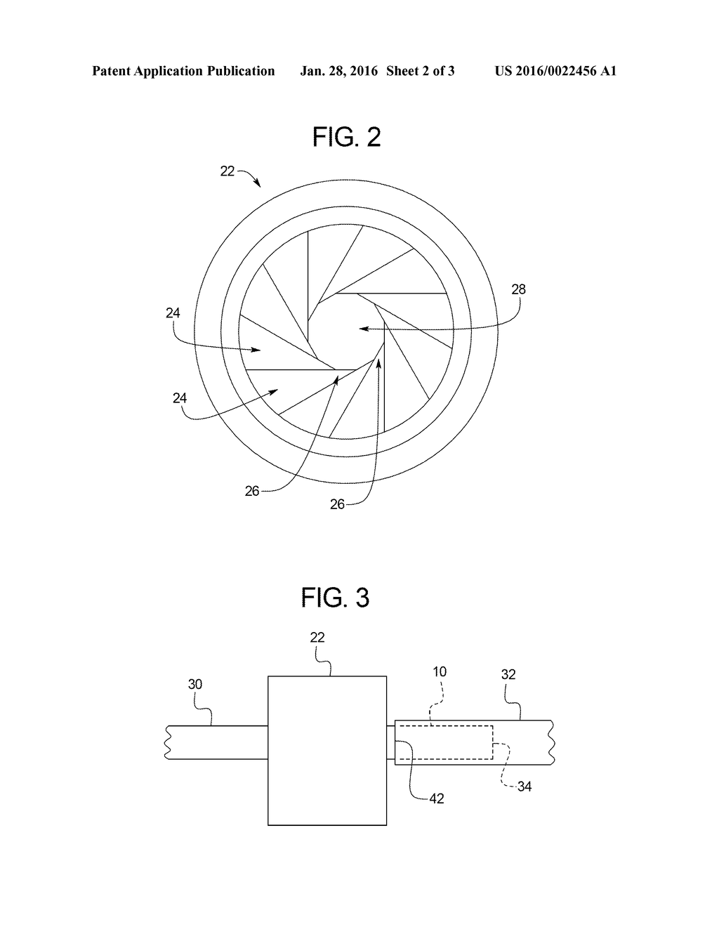 METHOD OF LOADING AND DELIVERING A SELF-EXPANDING STENT - diagram, schematic, and image 03