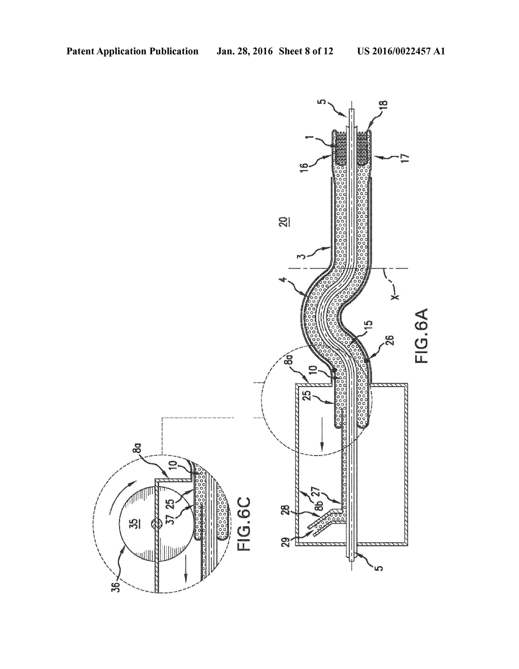 CATHETER WITH RETRACTABLE COVER AND PRESSURIZED FLUID - diagram, schematic, and image 09