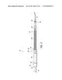 LUMINAL STENTING diagram and image